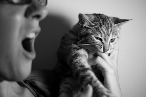 black-and-white photo of tabby cat biting a person's hand. The person's face in the foreground with an open mouth suggesting they are crying out in pain.